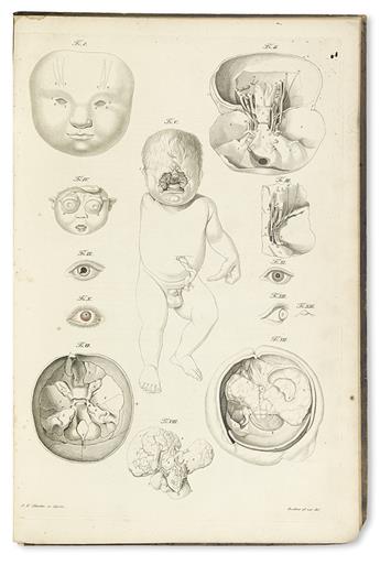 SEILER, BURKHARD WILHELM. Beobachtungen Ursprünglicher Bildungsfehler und gänzlichen Mangels der Augen.  1833